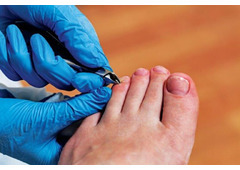 Kick Fungus to the Curb: Quick Guide to Onychomycosis (Toenail Fungus)