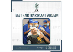 top hair transplant clinics Rajasthan
